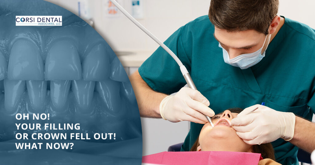 Your Filling Or Crown Came Out