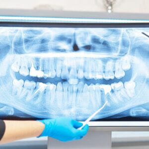 dental xray