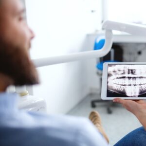 man looking at teeth xray
