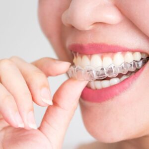 woman putting on Invisalign aligners