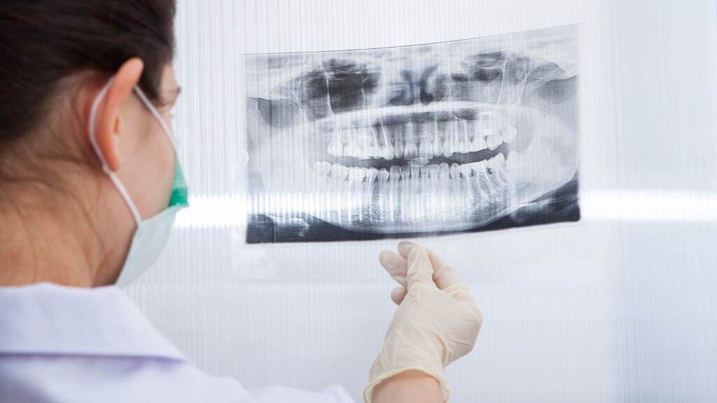 dentist looking at xray