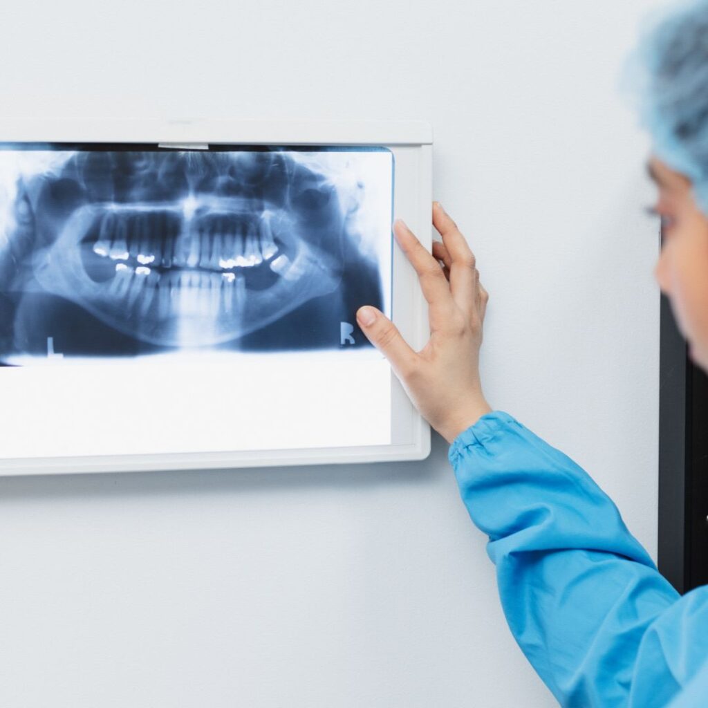 dental xray