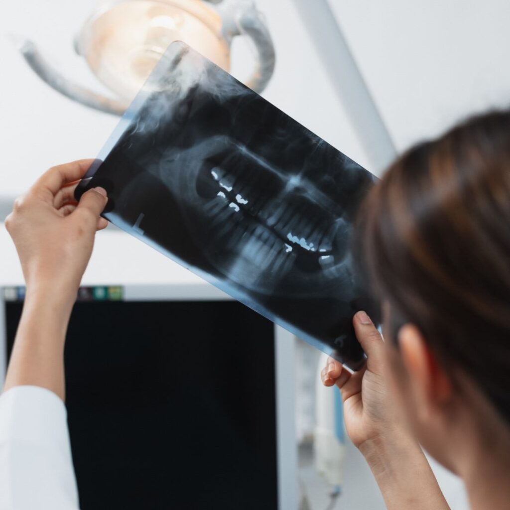 dental xray