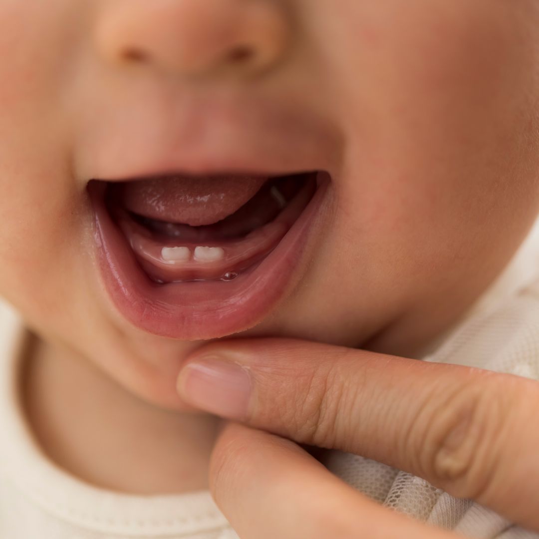baby with bottom teeth coming in