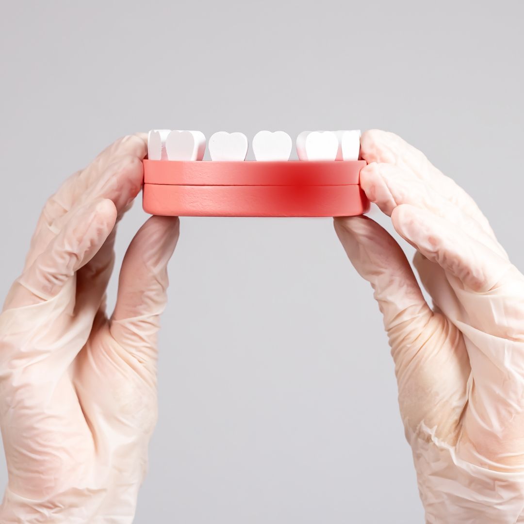 Dentist holding up half of a dental model.