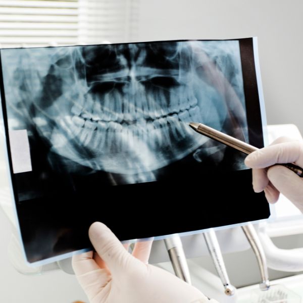 X ray