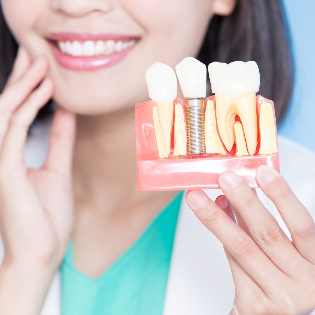 dentist holding a visual model showing a dental implant