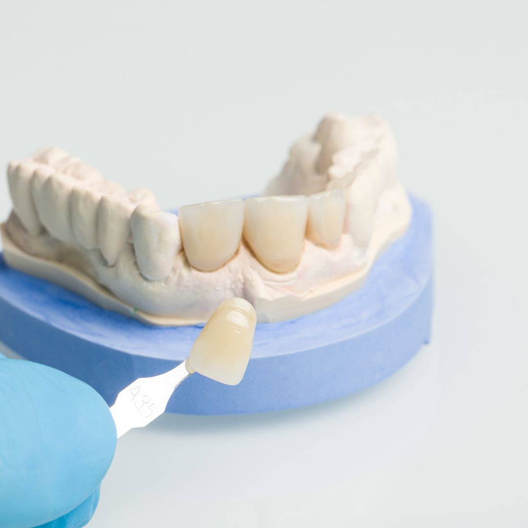 holding a crown up to a dental model