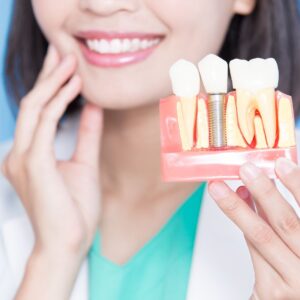 A dentist holding up a model of a dental implant