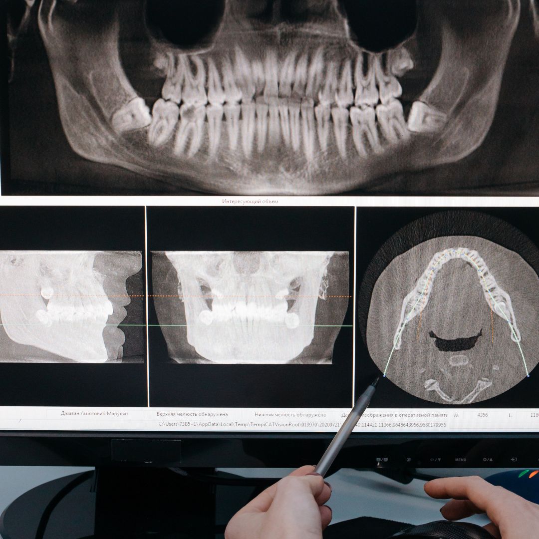 dental x-rays