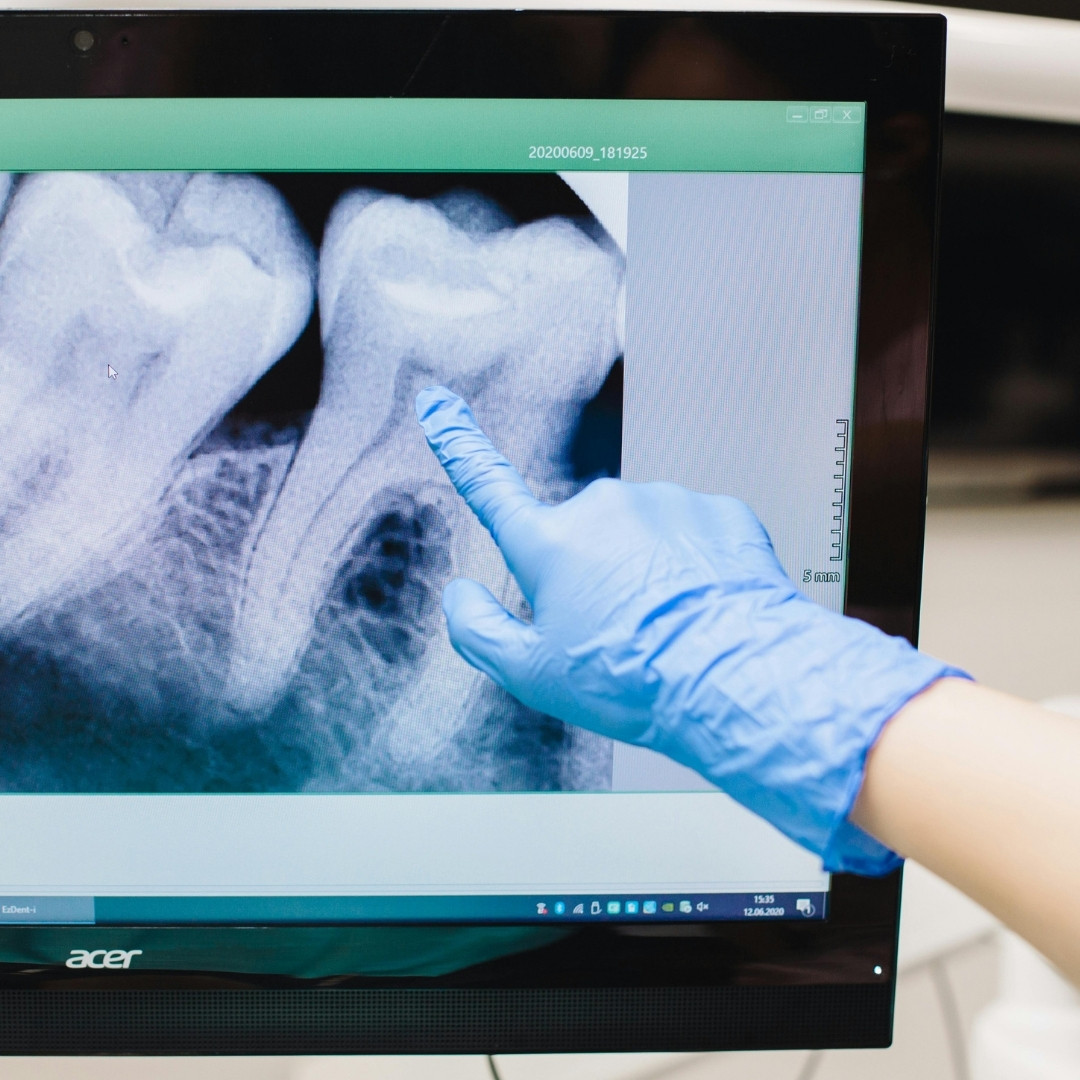 Where Compassion Meets Cutting-Edge Dentistry - Image 3